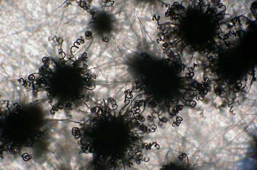 Black Mould Spores